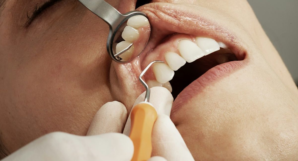 Dentist checking a sensitive tooth