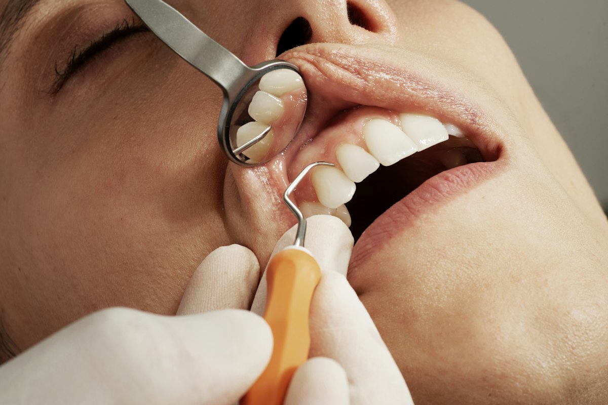Dentist checking a sensitive tooth